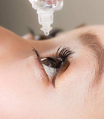 Woman using artificial tears for dry eye management