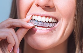 Woman putting Invisalign aligner on top teeth