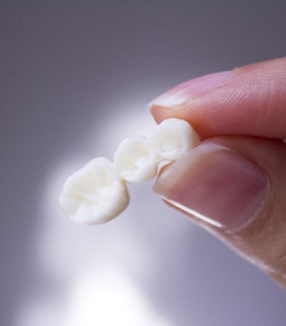 Close-up of a hand holding a dental bridge in Belmont, MA