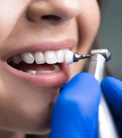 Female patient smiling before dental checkup and cleaning in Belmont, MA