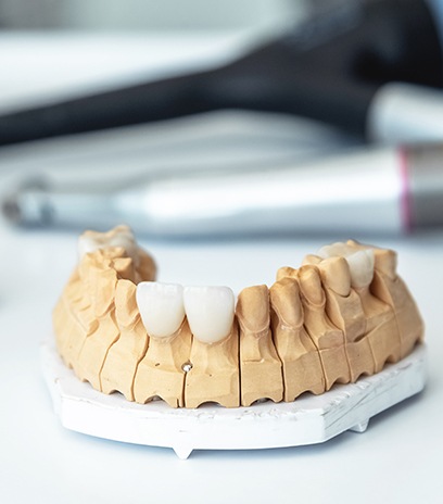 Model smile with dental crown restoration