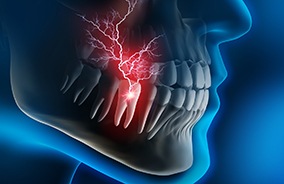 Diagram of a person with a dental emergency