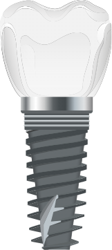 Animated dental implant supported replacement tooth