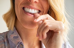 Close up of blonde woman putting Invisalign aligner over teeth