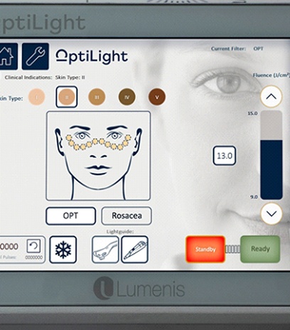 Close-up of device used for OptiLight treatment in Belmont, MA