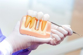 Dentist showing model of dental implant in Belmont, MA