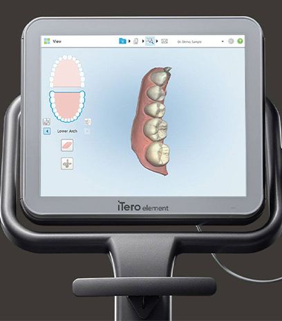 Digital impression system read out on computer screen