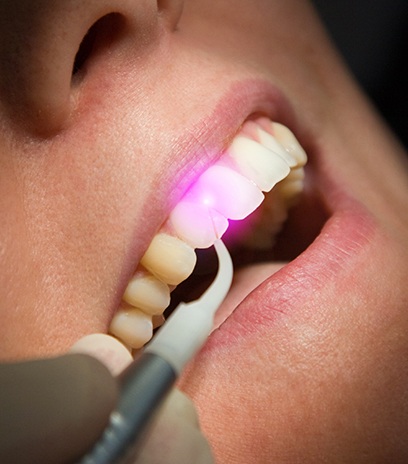 Patient receiving soft tissue laser dentistry treatment