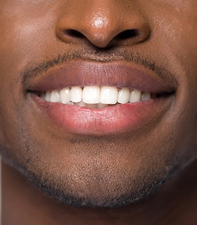 Close-up of a man’s smile after veneers