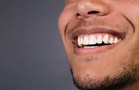 an attractive smile with veneers in Belmont