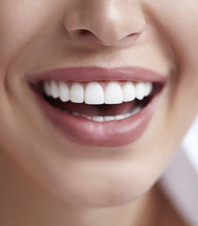 Woman sharing smile after at home teeth whitening